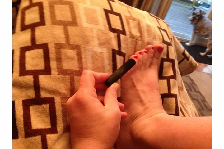 moxibustion pinky toe - Boston Moms Blog