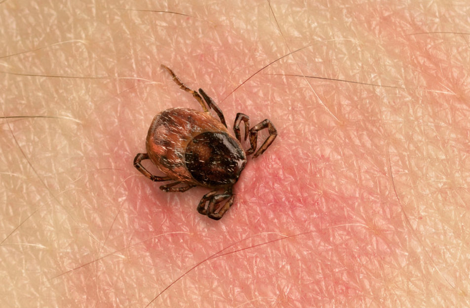 Lyme Disease What Moms Need To Know About Ticks