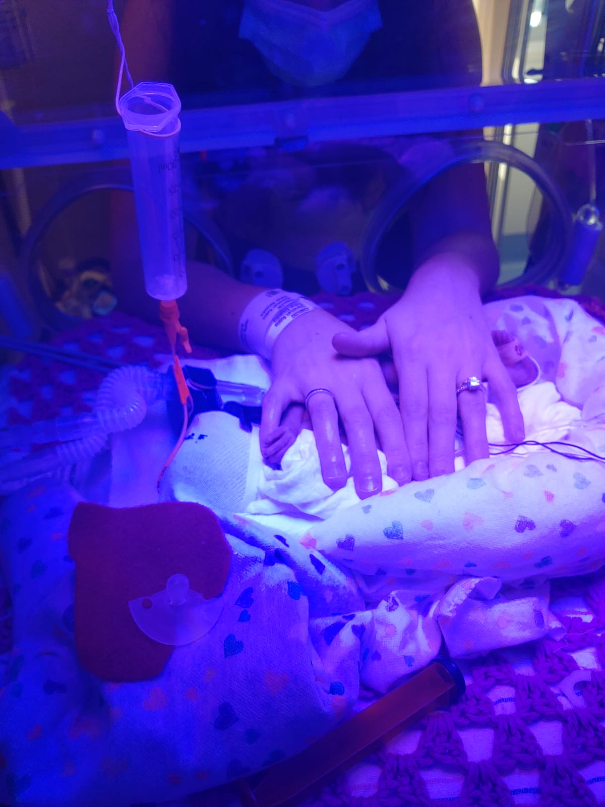 A mother's hands over a premature babies body inside an incubator.